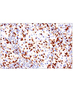 Cell Signaling CD103/ITGAE (EP206) Rabbit mAb