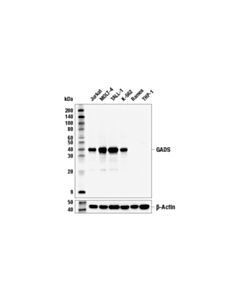 Cell Signaling GADS (E4O1V) Rabbit mAb 20 uL