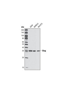 Cell Signaling Slug (C19g7) Rabbit mAb