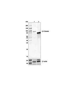 Cell Signaling Beta-Catenin Antibody (Carboxy-Terminal Antigen)