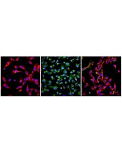 Cell Signaling BODIPY 581/591 C11 (Lipid Peroxidation Sensor) 1 mg