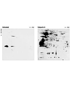 Cell Signaling Phospho-(Ser/Thr) Akt Substrate Antibody
