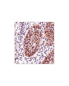 Cell Signaling Phospho-Akt Substrate (Rxxs*/T*) (110b7e) Rabbit mAb