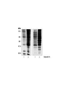 Cell Signaling Phospho-(Ser) Kinase Substrate Antibody Sampler Kit