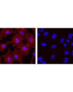 Cell Signaling Mouse (G3a1) mAb Igg1 Isotype Control (Alexa Fluor 555 Conjugate)