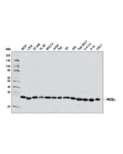 Cell Signaling Pa28alpha (D1c10) Rabbit mAb