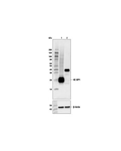 Cell Signaling 4e-Bp1 (53h11) Rabbit mAb