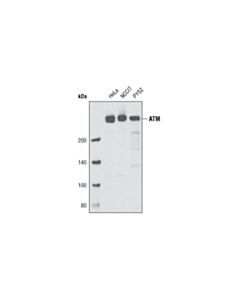 Cell Signaling Double Strand Breaks (Dsb) Repair Antibody Sampler Kit