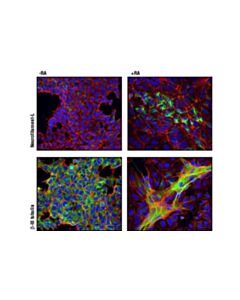 Cell Signaling Stemlight Pluripotency Antibody Kit