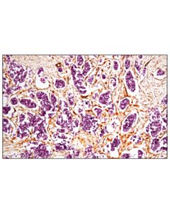 Cell Signaling Signalstain Vivid Purple Peroxidase Substrate Kit