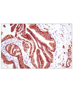 Cell Signaling E-Cadherin (24e10) Rabbit mAb (BSA And Azide Free)