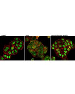 Cell Signaling Leptomycin B