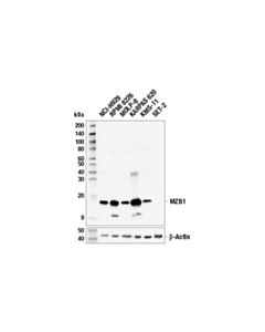 Cell Signaling Mzb1 (E8v4n) Rabbit mAb