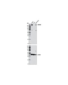 Cell Signaling Vegf Receptor 2 (D5b1) Rabbit mAb