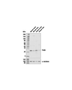 Cell Signaling Ykt6 Antibody
