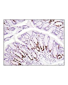 Cell Signaling Tumor Angiogenesis IHC Antibody Sampler Kit