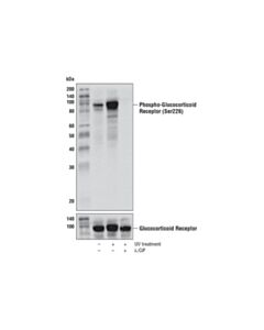 Cell Signaling Phospho-Glucocorticoid Receptor (Ser226) (D9d3v) Rabbit mAb