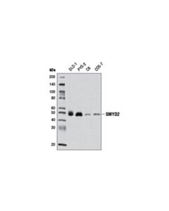 Cell Signaling Smyd2 (D14h7) Rabbit mAb