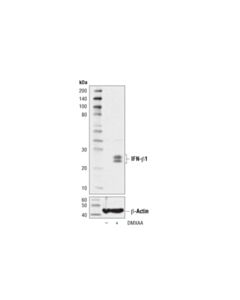 Cell Signaling IFN-beta1 (D2J1D) Rabbit mAb 20 uL