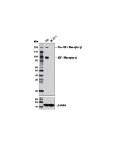 Cell Signaling Igf-I Receptor Beta (D23h3) Xp Rabbit mAb