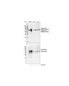 Cell Signaling Phospho-P70 S6 Kinase (Thr389) (D5u1o) Rabbit mAb