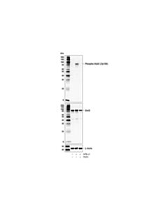 Cell Signaling Stattic
