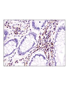 Cell Signaling Cxcr4 (D4z7w) Rabbit mAb (Ihc Specific)