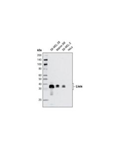 Cell Signaling Iap Family Antibody Sampler Kit