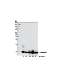 Cell Signaling Alzheimers Disease Antibody Sampler Kit