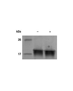 Cell Signaling Human IL-37 Recombinant Protein