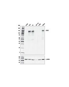 Cell Signaling Cd22 (E7l6z) Xp Rabbit mAb