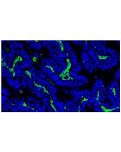 Cell Signaling Vimentin (D21H3) XP® Rabbit mAb (Alexa Fluor® 488 Conjugate); 20 µl