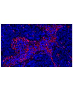Cell Signaling Vimentin (D21H3) Rabbit Monoclonal Antibody (Alexa Fluor ® 555 Conjugate)