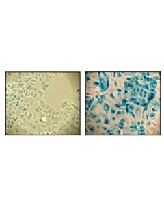Cell Signaling Senescence Beta-Galactosidase Staining Kit
