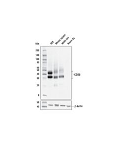 Cell Signaling Cd20 Antibody