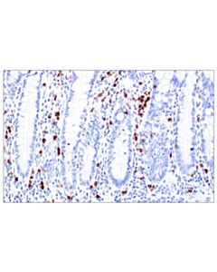 Cell Signaling Eosinophil peroxidase (F3C2H) Rabbit mAb; 20 µl