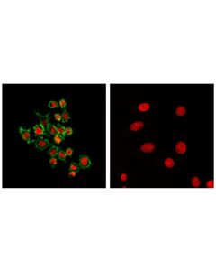 Cell Signaling Cd45 (D3f8q) Rabbit mAb (BSA And Azide Free)