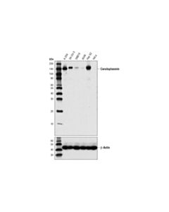 Cell Signaling Ceruloplasmin (D7q5w) Rabbit mAb