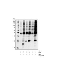 Cell Signaling Phospho-(Ser/Thr) Kinase Substrate Antibody Sampler Kit
