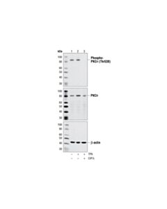 Cell Signaling Phospho-Pkc Antibody Sampler Kit