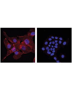 Cell Signaling N-Cadherin (D4r1h) Xp Rabbit mAb (Alexa Fluor 647 Conjugate)