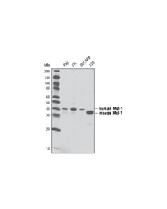 Cell Signaling Pro-Survival Bcl-2 Family Antibody Sampler Kit