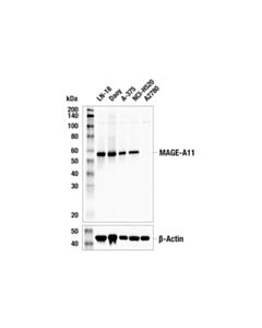 Cell Signaling Mage-A11 (E2f1k) Rabbit mAb