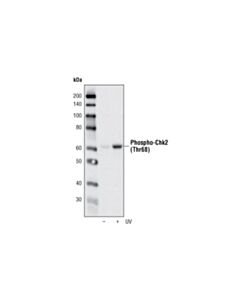 Cell Signaling Dna Damage Antibody Sampler Kit