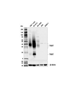 Cell Signaling Tigit (E5y1w) Xp<LT/>Sup&Gt;®<LT/>/Sup&Gt; Rabbit mAb