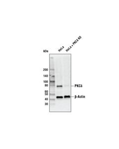 Cell Signaling Pkc Isoform Antibody Sampler Kit