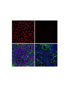 Cell Signaling Adar1 (E6x9r) Xp® Rabbit mAb (Alexa Fluor® 647 Conjugate)