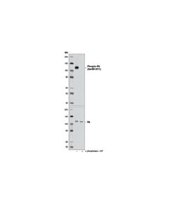 Cell Signaling Rb Antibody Sampler Kit