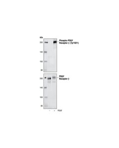 Cell Signaling Pdgf Receptor Beta Antibody Sampler Kit