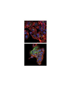 Cell Signaling Brefeldin A